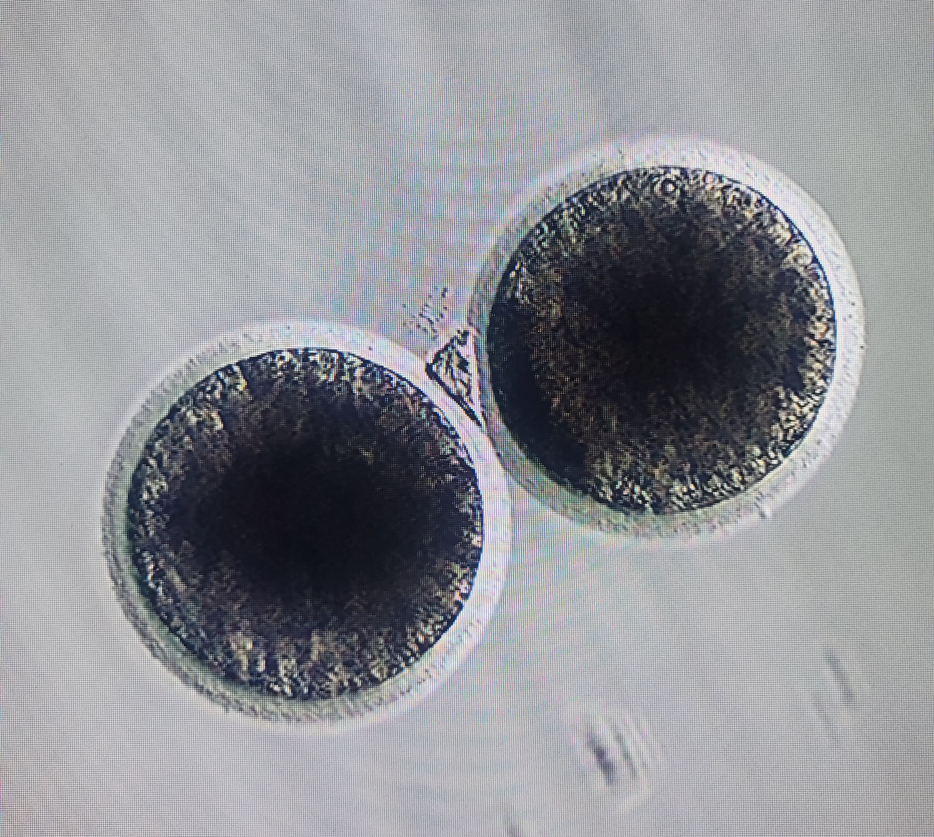 Embryo Storage